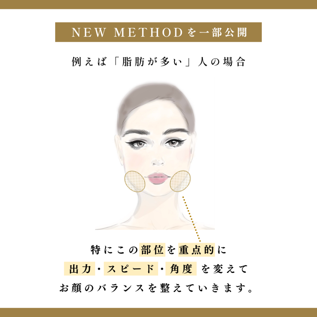 ソニックフィット