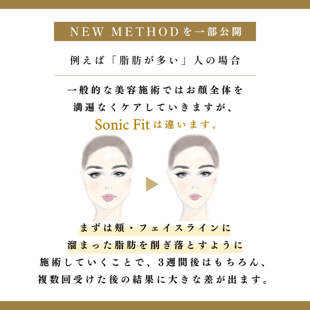 ソニックフィット