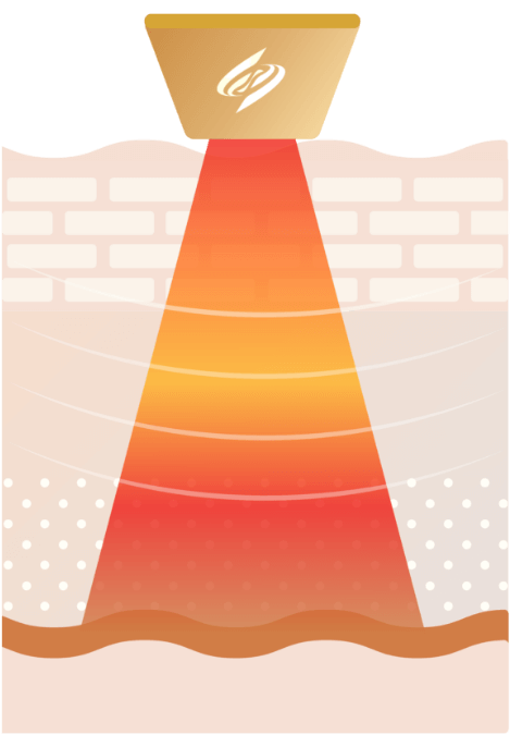 Sonic Fit ソニックフィット