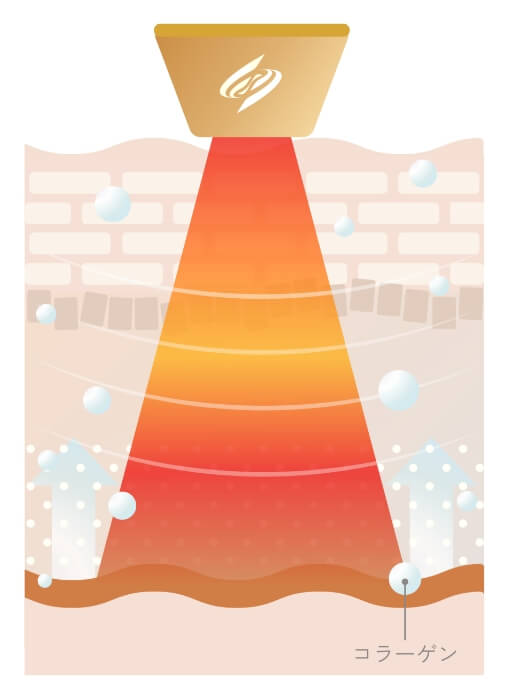独自の温熱刺激で衰えた細胞を活性化